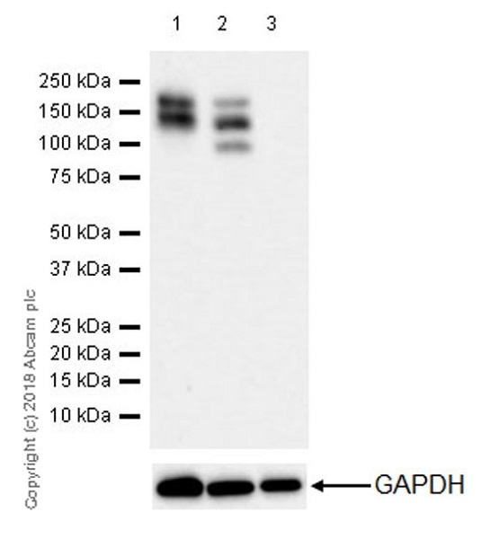 Western blot - Anti-PDGFR alpha antibody [EPR22059-270] (ab203491), expandable thumbnail