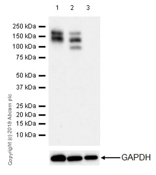 H.G.H アルファ Anti-PDGFR alpha antibody [EPR5480] KO tested (ab134123) | Abcam