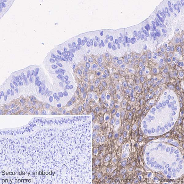 Immunohistochemistry (Formalin/PFA-fixed paraffin-embedded sections) - Anti-PDGFR alpha antibody [EPR22059-270] - BSA and Azide free (ab234965), expandable thumbnail