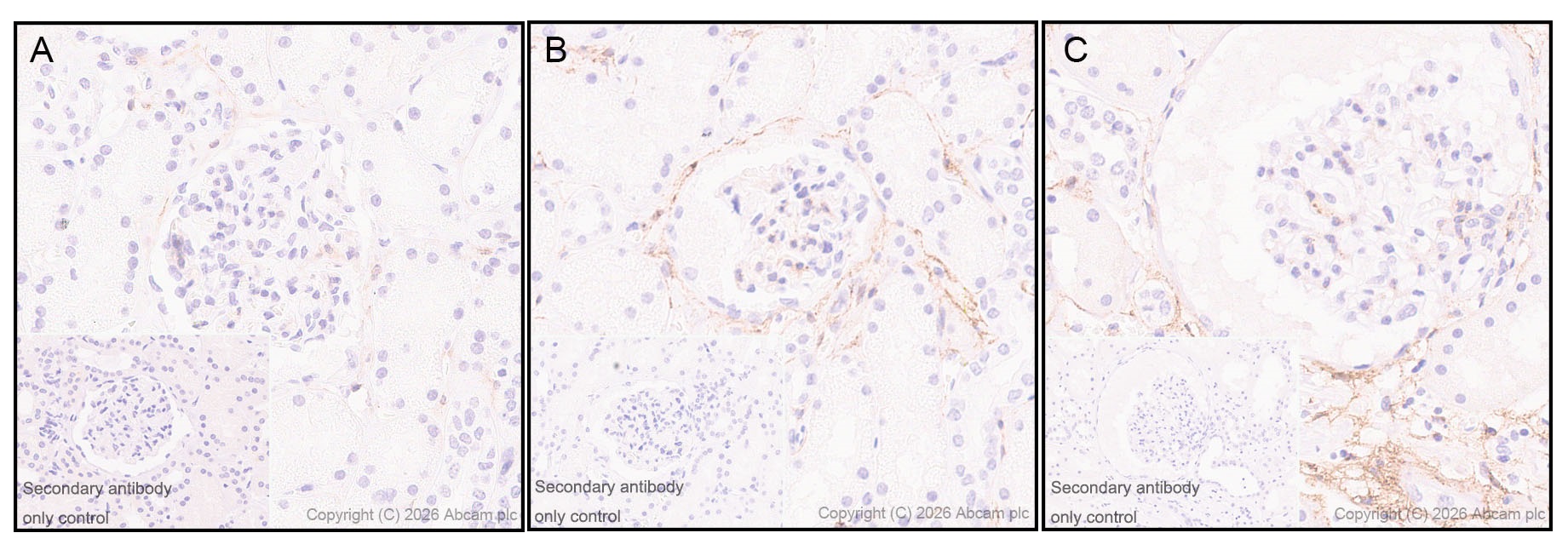 Immunohistochemistry (Formalin/PFA-fixed paraffin-embedded sections) - Anti-PDGFR alpha antibody [EPR22059-270] - BSA and Azide free (AB234965)