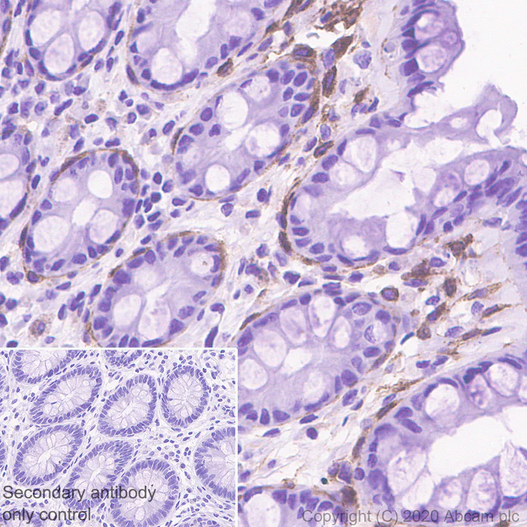 Immunohistochemistry (Formalin/PFA-fixed paraffin-embedded sections) - Anti-PDGFR alpha antibody [EPR5480] (AB134123)