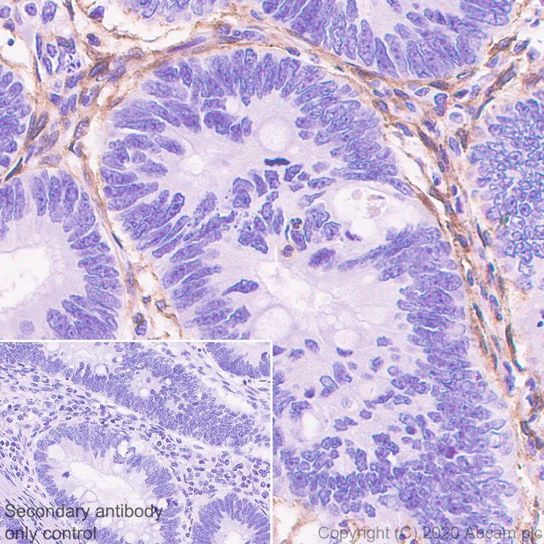 Immunohistochemistry (Formalin/PFA-fixed paraffin-embedded sections) - Anti-PDGFR alpha antibody [EPR5480] - BSA and Azide free (AB248689)