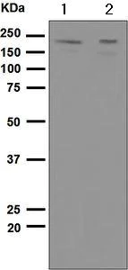 Western blot - Anti-PDGFR alpha antibody [EPR5480] - BSA and Azide free (AB248689)