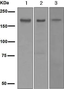 Western blot - Anti-PDGFR alpha antibody [EPR5480] - BSA and Azide free (AB248689)