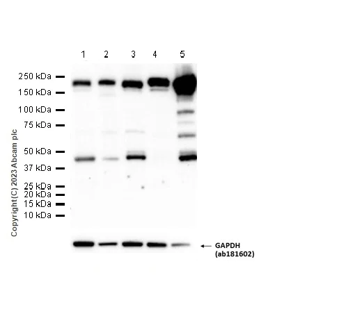 Western blot - Anti-PDGFR alpha antibody [EPR5480] - BSA and Azide free (AB248689)