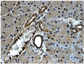 Immunohistochemistry (Formalin/PFA-fixed paraffin-embedded sections) - Anti-PDGFR alpha antibody [RM0004-3G28] (AB51875)