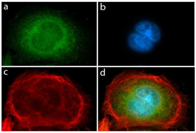 Immunocytochemistry/ Immunofluorescence - Anti-PDGFR alpha Antibody [RP23040031] (AB313400), expandable thumbnail