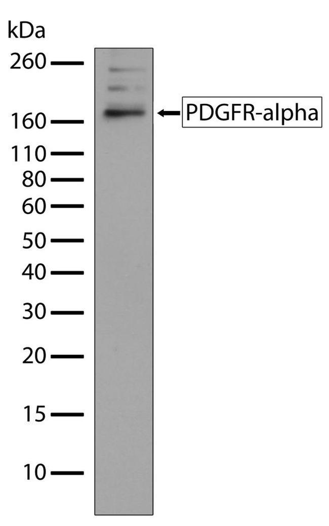 Western blot - Anti-PDGFR alpha Antibody [RP23040031] (AB313400), expandable thumbnail