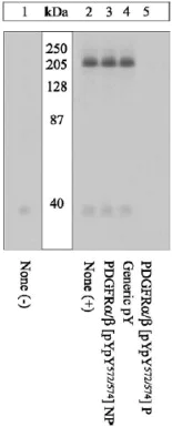 Western blot - Anti-PDGFR alpha + Beta (phospho Y572 + Y574) antibody (AB5443)