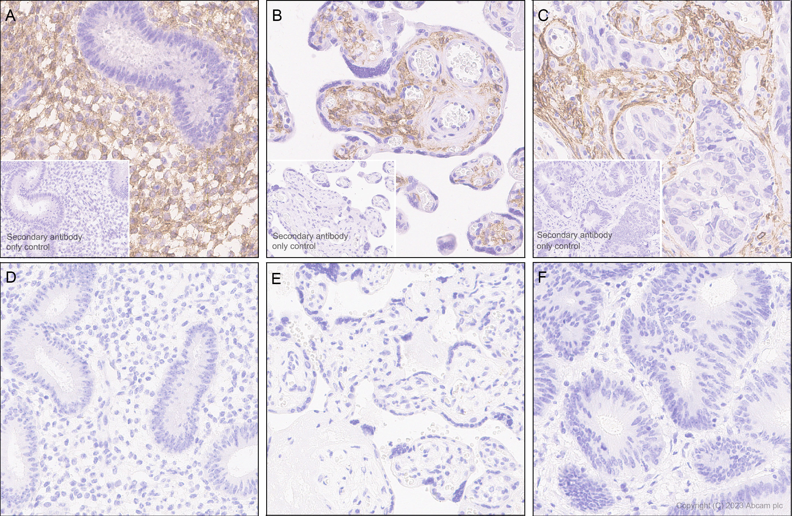 Immunohistochemistry (Formalin/PFA-fixed paraffin-embedded sections) - Anti-PDGFR alpha (mutated D842V) antibody [EPR26304-280] (AB313771), expandable thumbnail