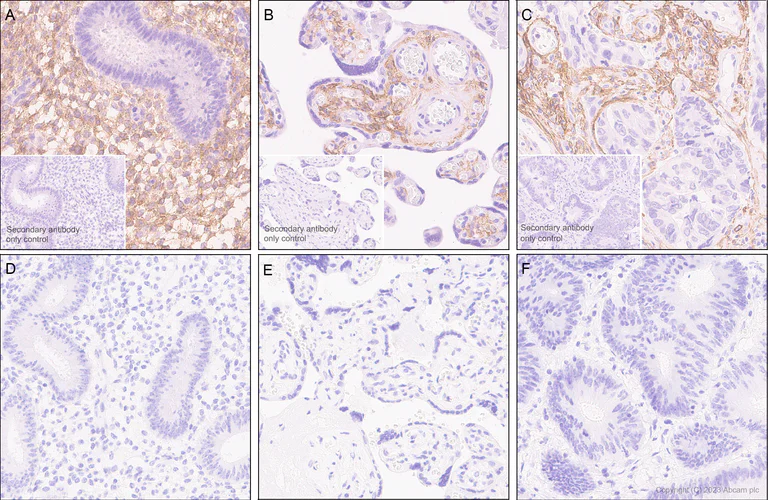 Immunohistochemistry (Formalin/PFA-fixed paraffin-embedded sections) - Anti-PDGFR alpha (mutated D842V) antibody [EPR26304-280] (AB313771)