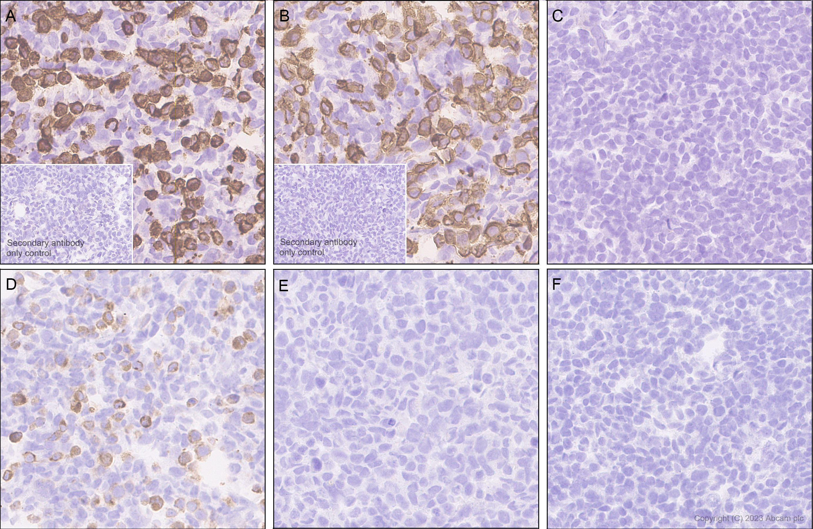 Immunohistochemistry (Formalin/PFA-fixed paraffin-embedded sections) - Anti-PDGFR alpha (mutated D842V) antibody [EPR26304-280] (ab313771), expandable thumbnail