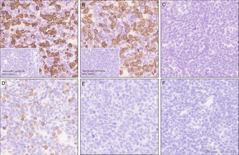 Immunohistochemistry (Formalin/PFA-fixed paraffin-embedded sections) - Anti-PDGFR alpha (mutated D842V) antibody [EPR26304-280] (AB313771)