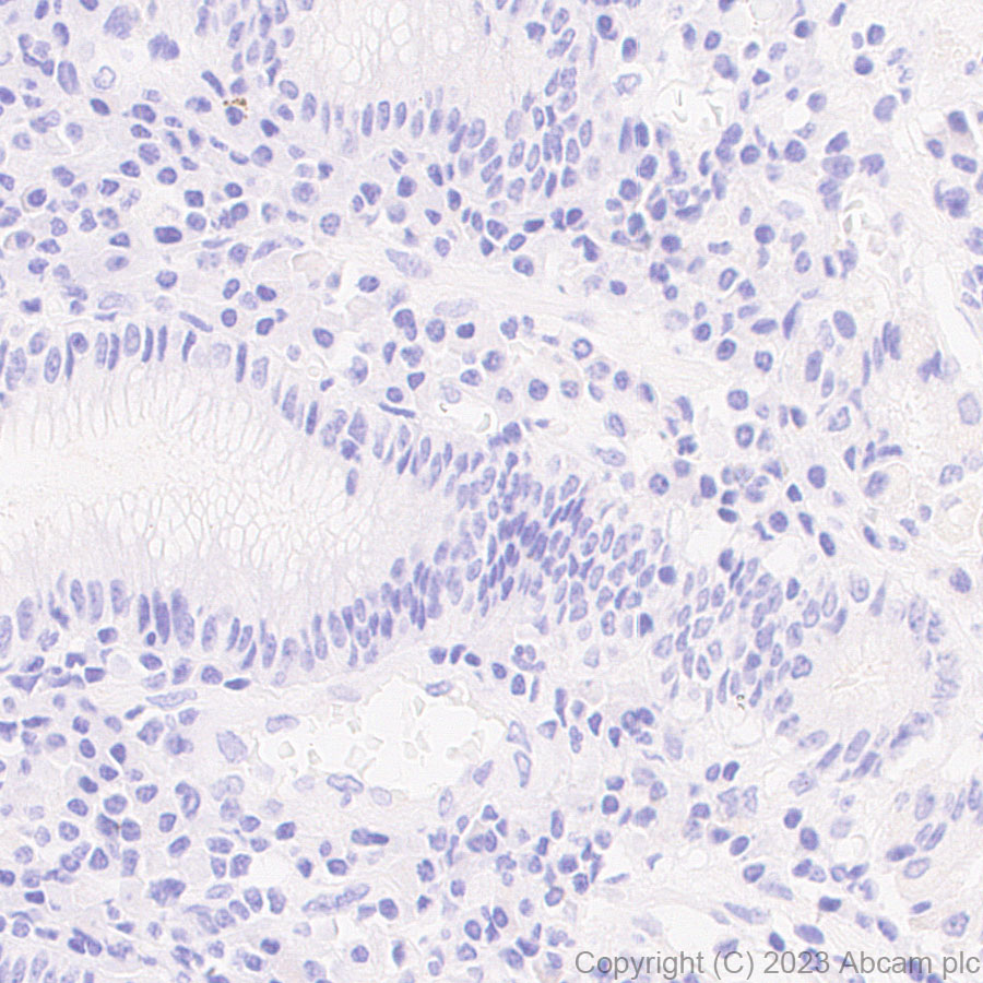 Immunohistochemistry (Formalin/PFA-fixed paraffin-embedded sections) - Anti-PDGFR alpha (mutated D842V) antibody [EPR26304-280] (ab313771), expandable thumbnail