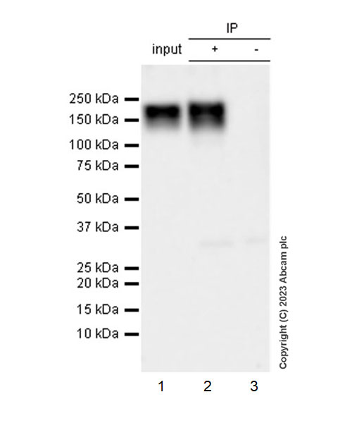 Immunoprecipitation - Anti-PDGFR alpha (mutated D842V) antibody [EPR26304-280] (AB313771), expandable thumbnail