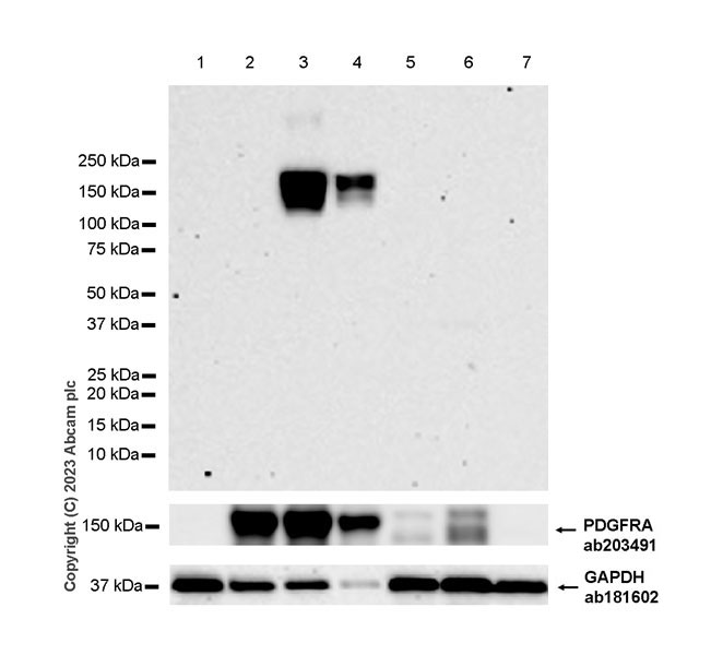 Western blot - Anti-PDGFR alpha (mutated D842V) antibody [EPR26304-280] (AB313771), expandable thumbnail