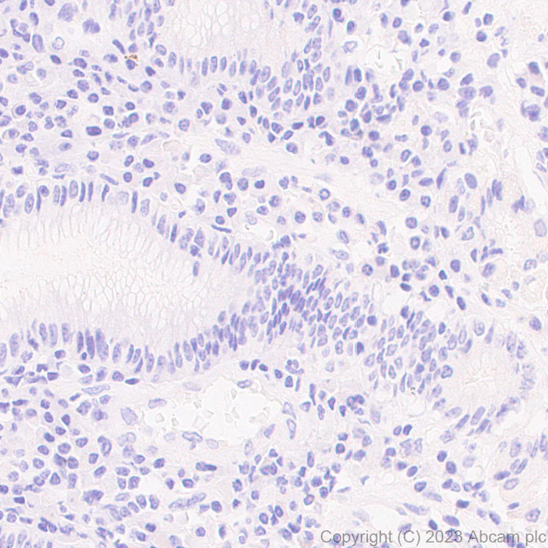 Immunohistochemistry (Formalin/PFA-fixed paraffin-embedded sections) - Anti-PDGFR alpha (mutated D842V) antibody [EPR26304-280] - BSA and Azide free (AB313772)