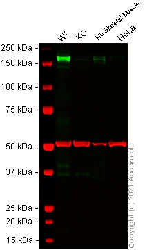 Western blot - Anti-PDGFR alpha + PDGFR beta antibody [Y92] - BSA and Azide free (AB271835)
