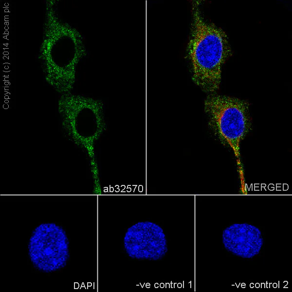 Anti-PDGFR alpha + PDGFR beta antibody [Y92] KO tested