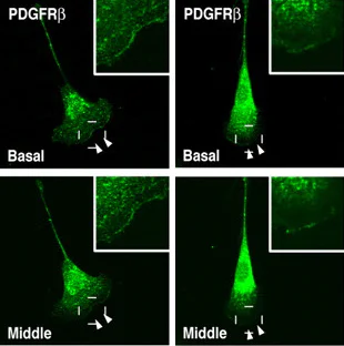 Immunocytochemistry/ Immunofluorescence - Anti-PDGFR alpha + PDGFR beta antibody [Y92] - C-terminal (AB32570)