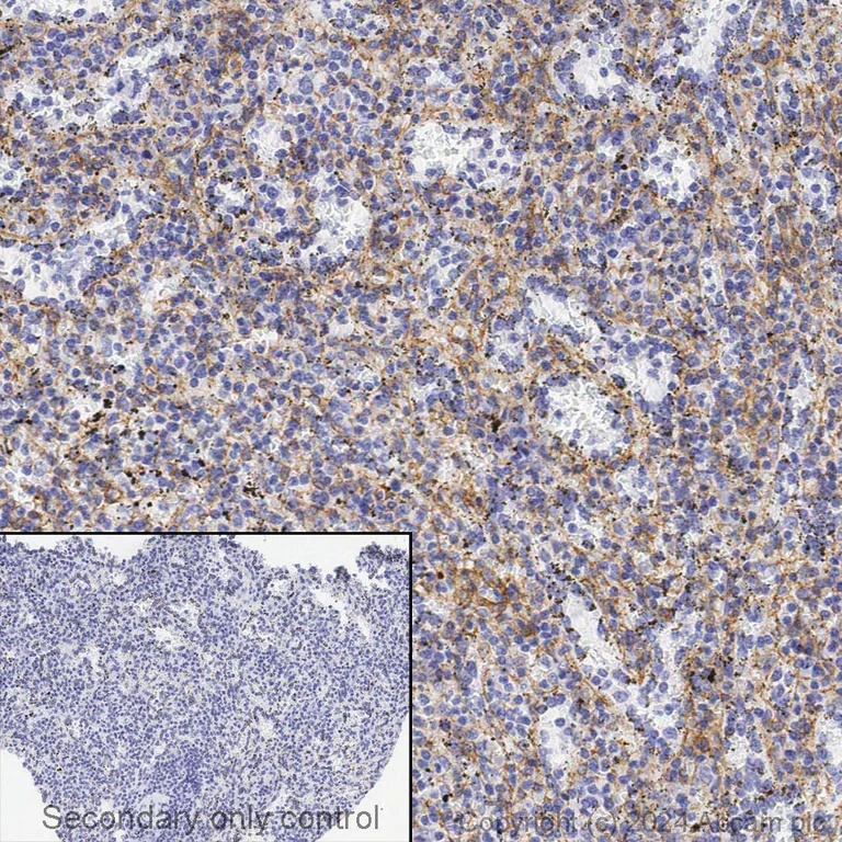 Immunohistochemistry (Formalin/PFA-fixed paraffin-embedded sections) - Anti-PDGFR alpha + PDGFR beta antibody [Y92] - C-terminal (AB32570)