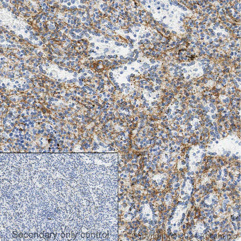 Immunohistochemistry (Formalin/PFA-fixed paraffin-embedded sections) - Anti-PDGFR alpha + PDGFR beta antibody [Y92] - C-terminal (AB32570)