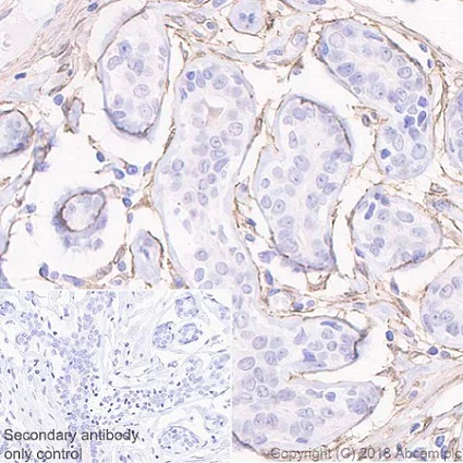 Immunohistochemistry (Formalin/PFA-fixed paraffin-embedded sections) - Anti-PDGFR alpha + PDGFR beta antibody [Y92] - C-terminal (AB32570)