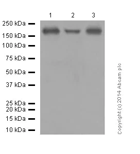 Western blot - Anti-PDGFR alpha + PDGFR beta antibody [Y92] - C-terminal (AB32570)