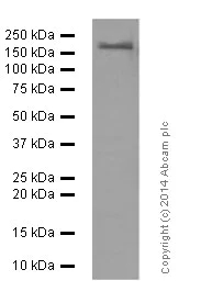 Western blot - Anti-PDGFR alpha + PDGFR beta antibody [Y92] - C-terminal (AB32570)