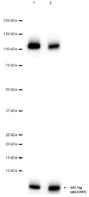 Western blot - Anti-PDGFR alpha + PDGFR beta antibody [Y92] - C-terminal (AB32570)