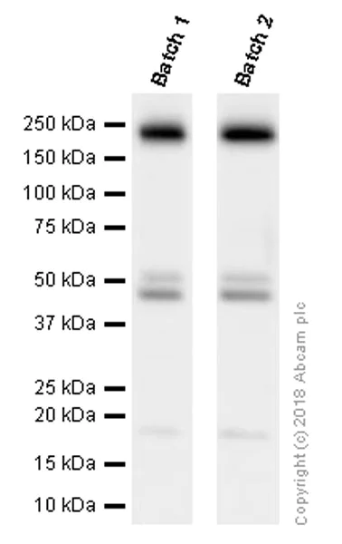 Western blot - Anti-PDGFR alpha + PDGFR beta antibody [Y92] - C-terminal (AB32570)