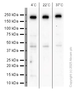 Western blot - Anti-PDGFR alpha + PDGFR beta antibody [Y92] - C-terminal (AB32570)