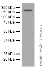 Western blot - Anti-PDGFR alpha + PDGFR beta antibody [Y92] - C-terminal (AB32570)