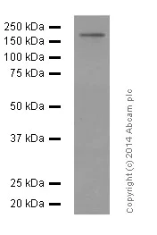 Western blot - Anti-PDGFR alpha + PDGFR beta antibody [Y92] - C-terminal (AB32570)