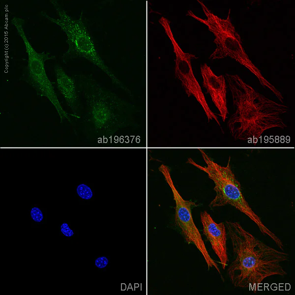 Immunocytochemistry/ Immunofluorescence - Anti-PDGFR alpha + PDGFR beta antibody [Y92] - Low endotoxin, Azide free (AB215978)