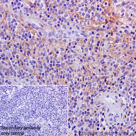 Immunohistochemistry (Formalin/PFA-fixed paraffin-embedded sections) - Anti-PDGFR alpha + PDGFR beta antibody [Y92] - Low endotoxin, Azide free (AB215978)