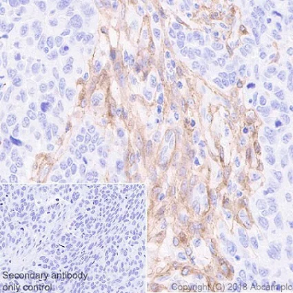 Immunohistochemistry (Formalin/PFA-fixed paraffin-embedded sections) - Anti-PDGFR alpha + PDGFR beta antibody [Y92] - Low endotoxin, Azide free (AB215978)