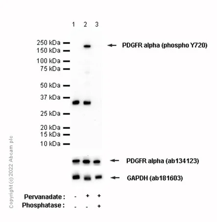 Western blot - Anti-PDGFR alpha (phospho Y720) antibody [EP2478] - BSA and Azide free (AB248668)