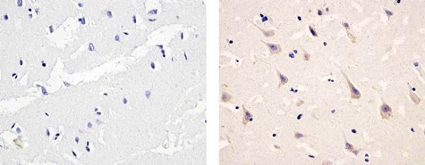 Immunohistochemistry (Formalin/PFA-fixed paraffin-embedded sections) - Anti-PDGFR alpha (phospho Y754) antibody (AB5460), expandable thumbnail