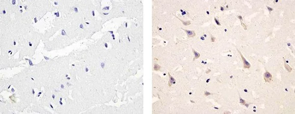 Immunohistochemistry (Formalin/PFA-fixed paraffin-embedded sections) - Anti-PDGFR alpha (phospho Y754) antibody (AB5460)