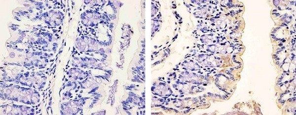 Immunohistochemistry (Formalin/PFA-fixed paraffin-embedded sections) - Anti-PDGFR alpha (phospho Y754) antibody (AB5460), expandable thumbnail