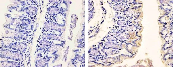 Immunohistochemistry (Formalin/PFA-fixed paraffin-embedded sections) - Anti-PDGFR alpha (phospho Y754) antibody (AB5460)