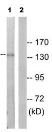 Western blot - Anti-PDGFR alpha (phospho Y849) antibody (AB79318)