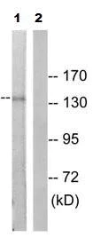 Western blot - Anti-PDGFR alpha (phospho Y849) antibody (AB79318)