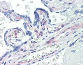 Immunohistochemistry (Formalin/PFA-fixed paraffin-embedded sections) - Anti-PDGFR beta antibody [42G12] (AB69506)