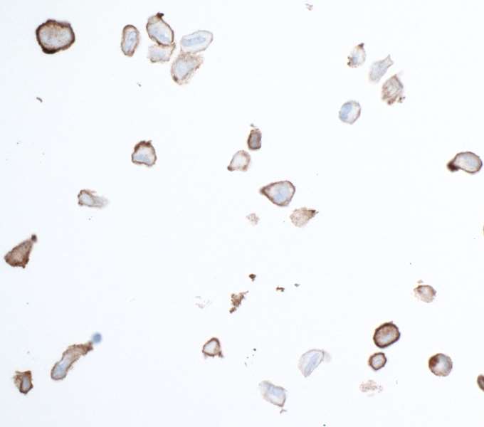 Immunocytochemistry - Anti-PDGFR beta antibody [BLR081G] - BSA free (AB314096), expandable thumbnail