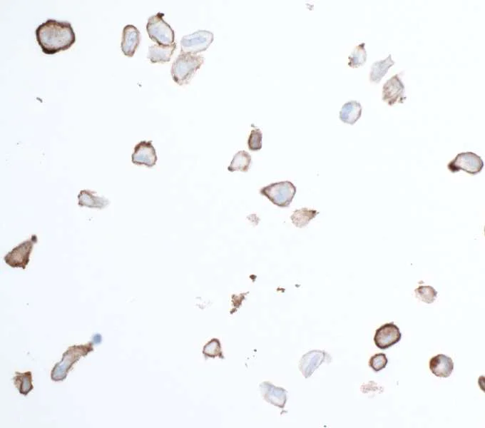 Immunocytochemistry - Anti-PDGFR beta antibody [BLR081G] - BSA free (AB314096)