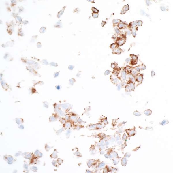 Immunocytochemistry - Anti-PDGFR beta antibody [BLR081G] - BSA free (AB314096), expandable thumbnail