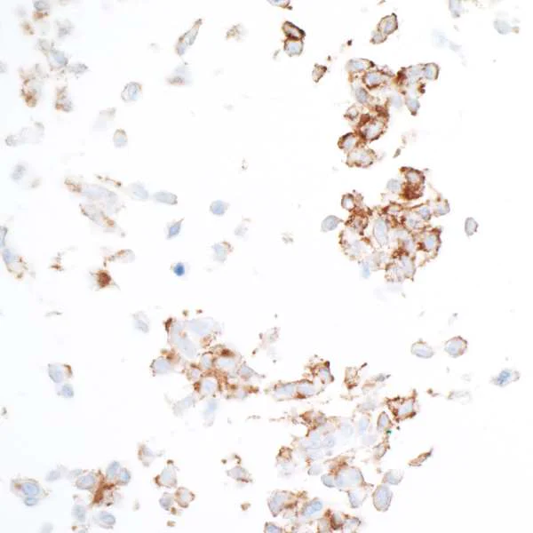 Immunocytochemistry - Anti-PDGFR beta antibody [BLR081G] - BSA free (AB314096)