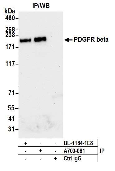Immunoprecipitation - Anti-PDGFR beta antibody [BLR081G] - BSA free (AB314096), expandable thumbnail